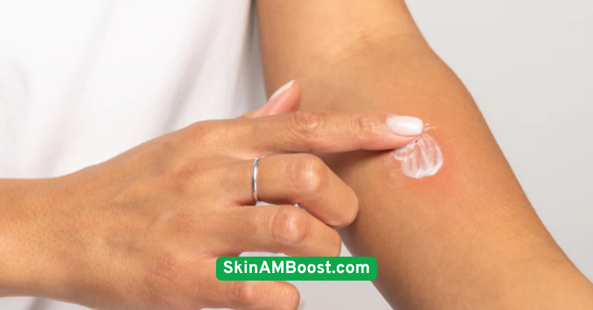 Always Patch Test New Ingredients